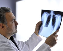 Röntgen-Thorax (radiologisches Lungenbild)