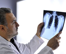 Röntgen-Thorax (radiologisches Lungenbild) Röntgen-Thorax (radiologisches Lungenbild)